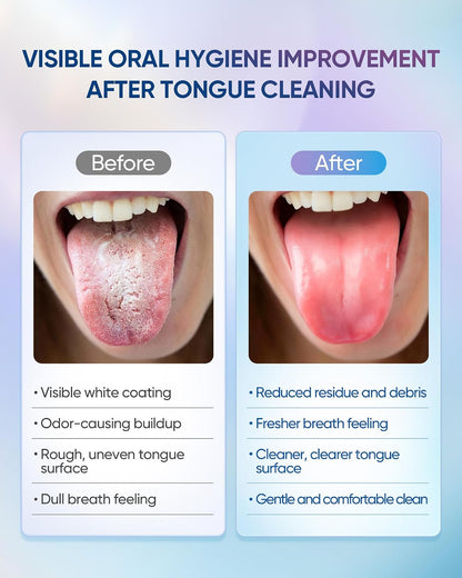 Japanese Tongue Cleaner Kit